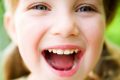 Здоровые зубки — детские радостные улыбки