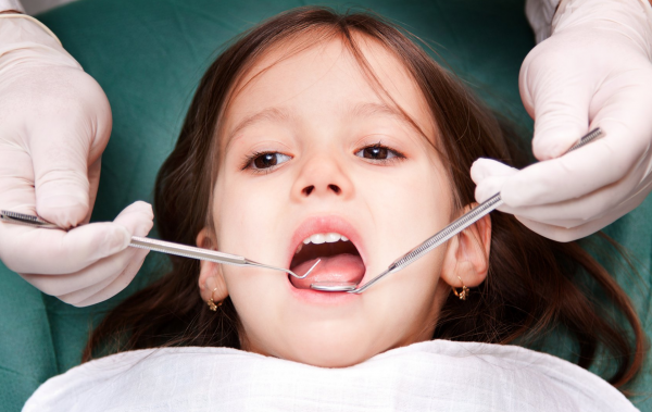 Серебрение зубов детям: достоинства и недостатки этого метода