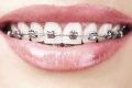 Стоматология. Признаки необходимости косметической стоматологии