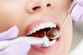 Как кариес разрушает зуб?