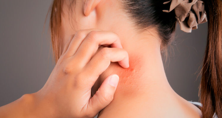 Зуд кожи: сигналы организма о проблемах со здоровьем. Женский взгляд