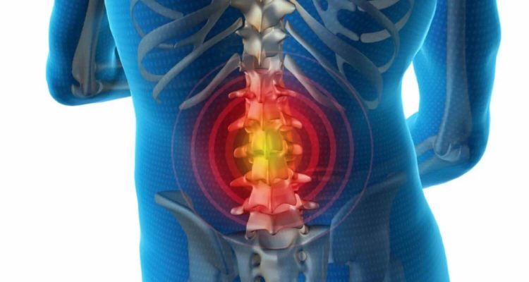 Первые признаки грыжи позвоночника: не пропустите тревожные сигналы