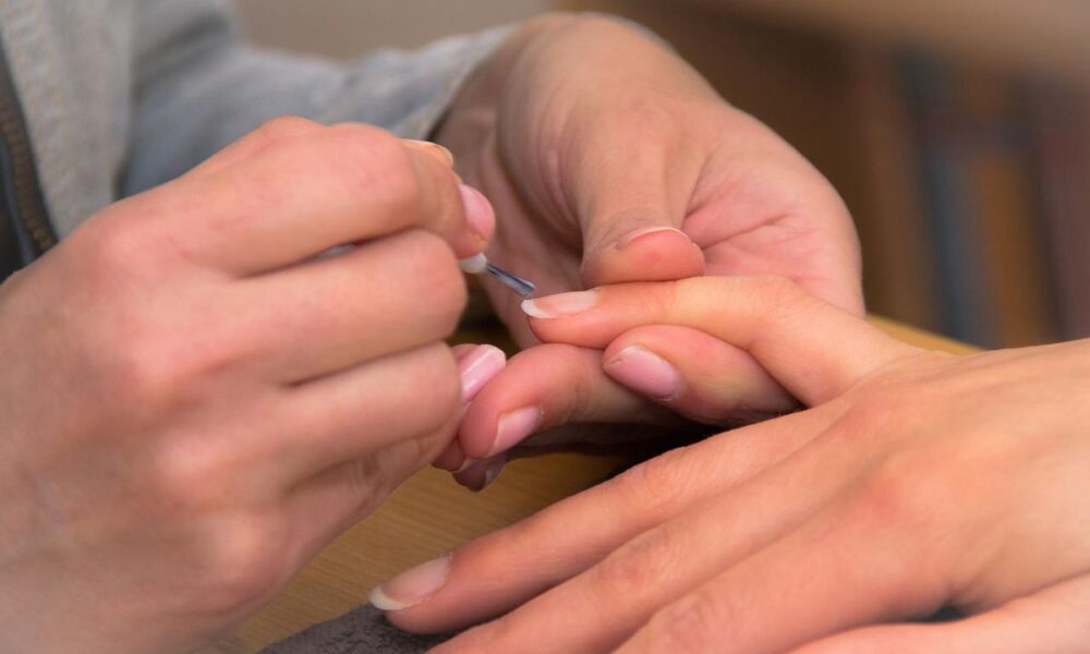 Ломкие и слабые ногти: причины и эффективные методы укрепления для женских ручек