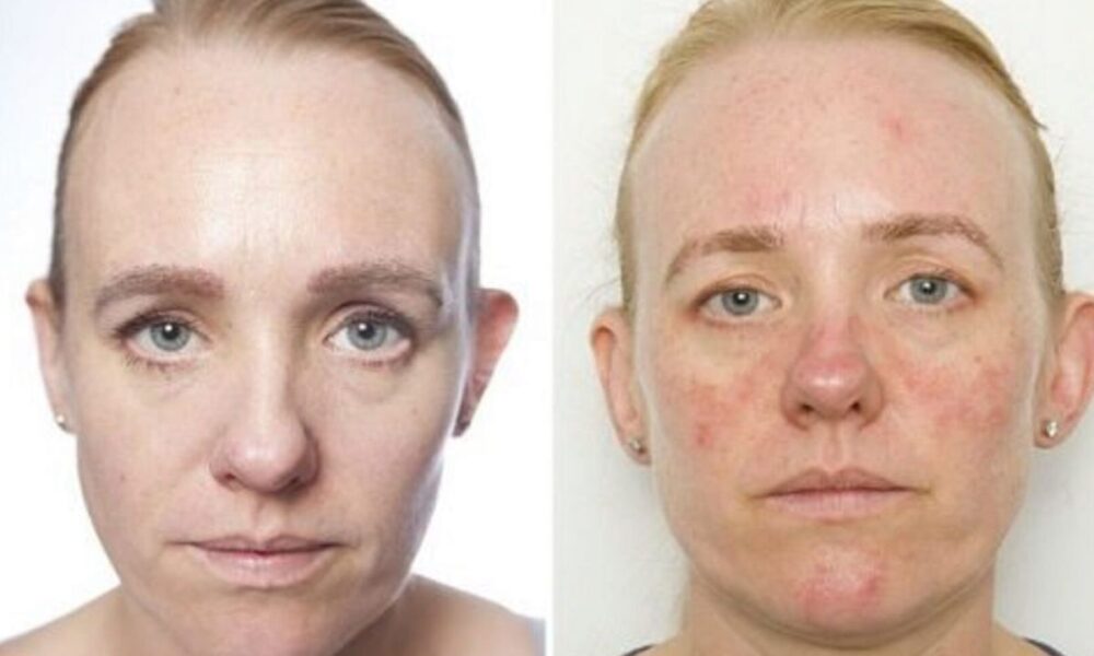 Что случится с кожей, если не умываться: последствия для красоты и здоровья