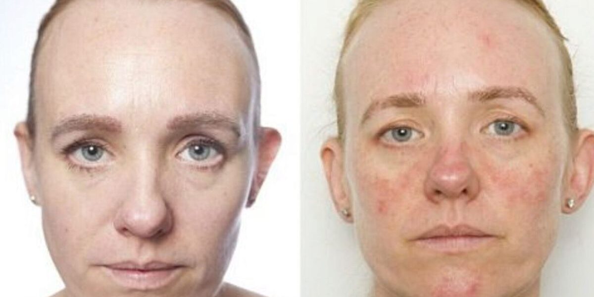 Что случится с кожей, если не умываться: последствия для красоты и здоровья