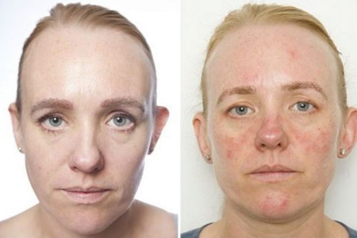 Что случится с кожей, если не умываться: последствия для красоты и здоровья