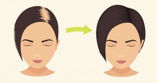 Сода для волос: секреты роста и красоты от женского портала