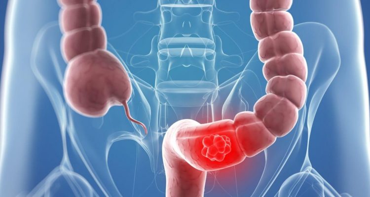 Три тревожных сигнала кишечника: что важно знать каждой женщине