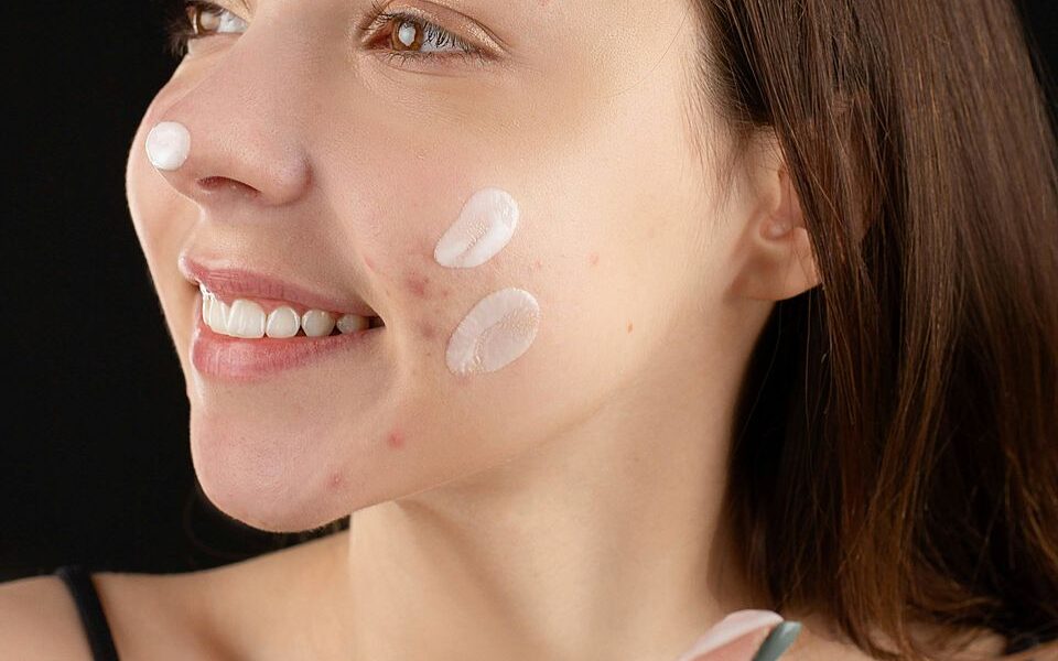 Высыпания после новой косметики: аллергия или очищение кожи?