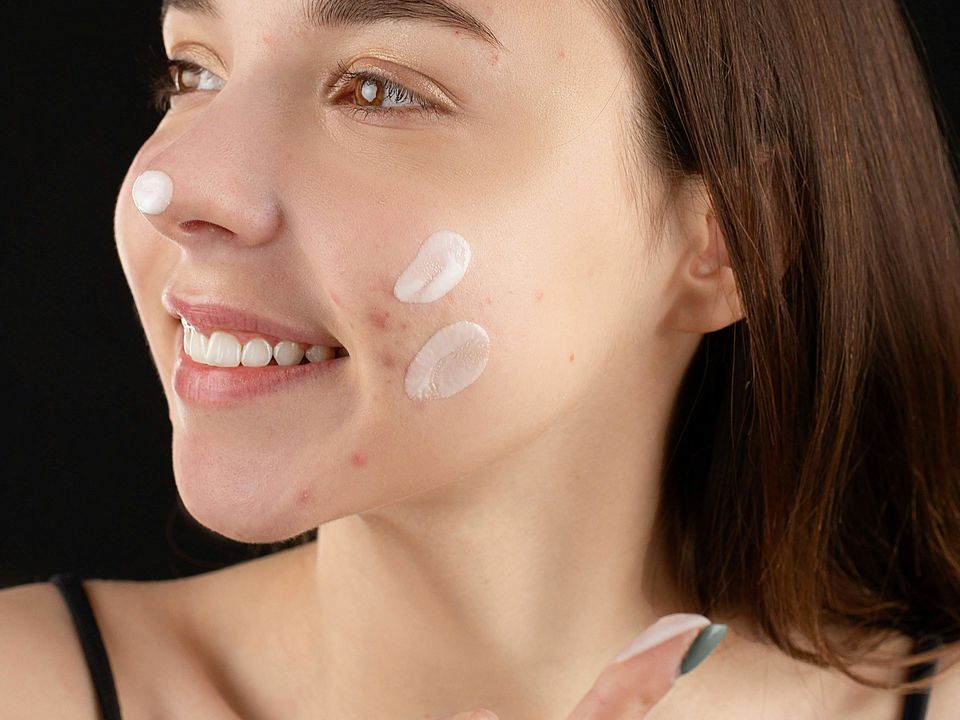 Высыпания после новой косметики: аллергия или очищение кожи?