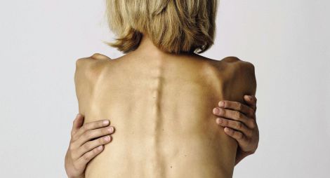 Худоба и здоровье: опасности для женщин