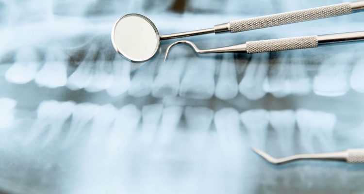 Вредные привычки для зубов: что портит вашу улыбку