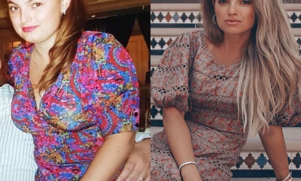 Стресс и красота: как тревога влияет на твою внешность