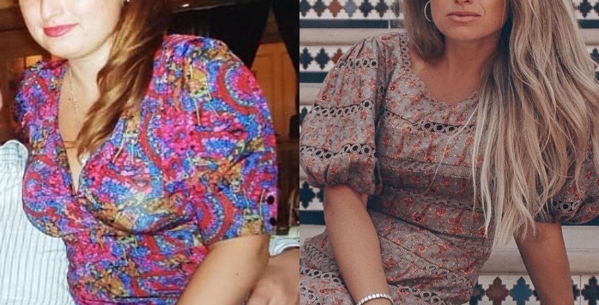 Стресс и красота: как тревога влияет на твою внешность