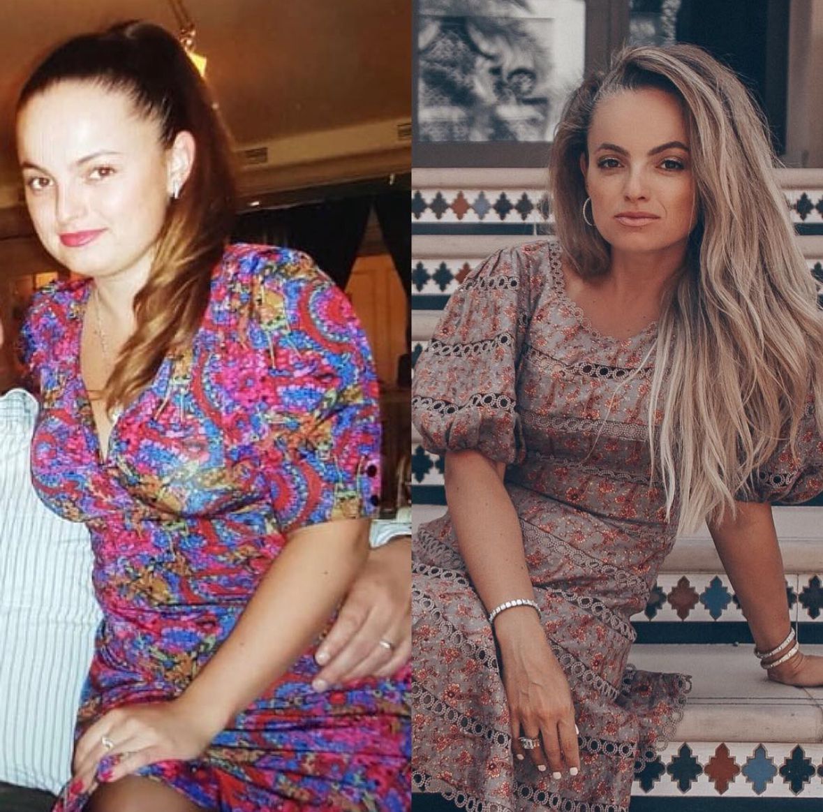 Стресс и красота: как тревога влияет на твою внешность