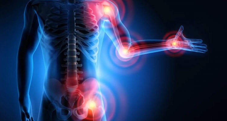 Топ-10 продуктов для здоровья суставов: что добавить в рацион женщине