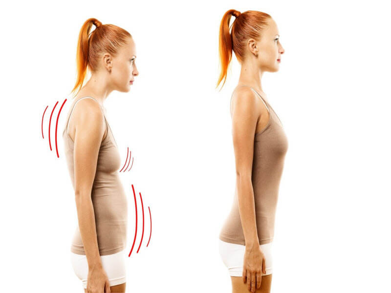 Красивая осанка – здоровая спина: миф или реальность?