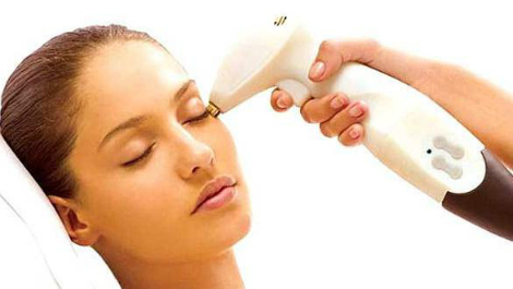 Удаление веснушек лазером: все о процедуре для здоровья кожи