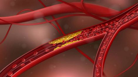 Холестерин: 3 главных мифа, которые пора развеять каждой женщине