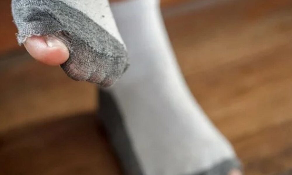 Не носи дырявые носки: почему это вредит кошельку и здоровью