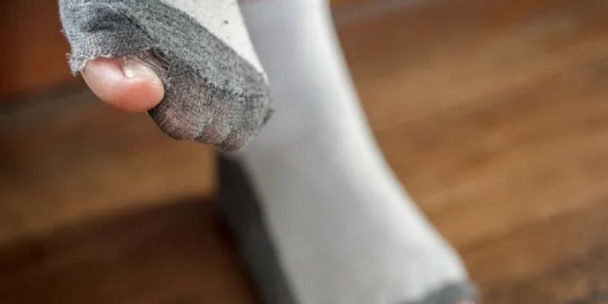 Не носи дырявые носки: почему это вредит кошельку и здоровью