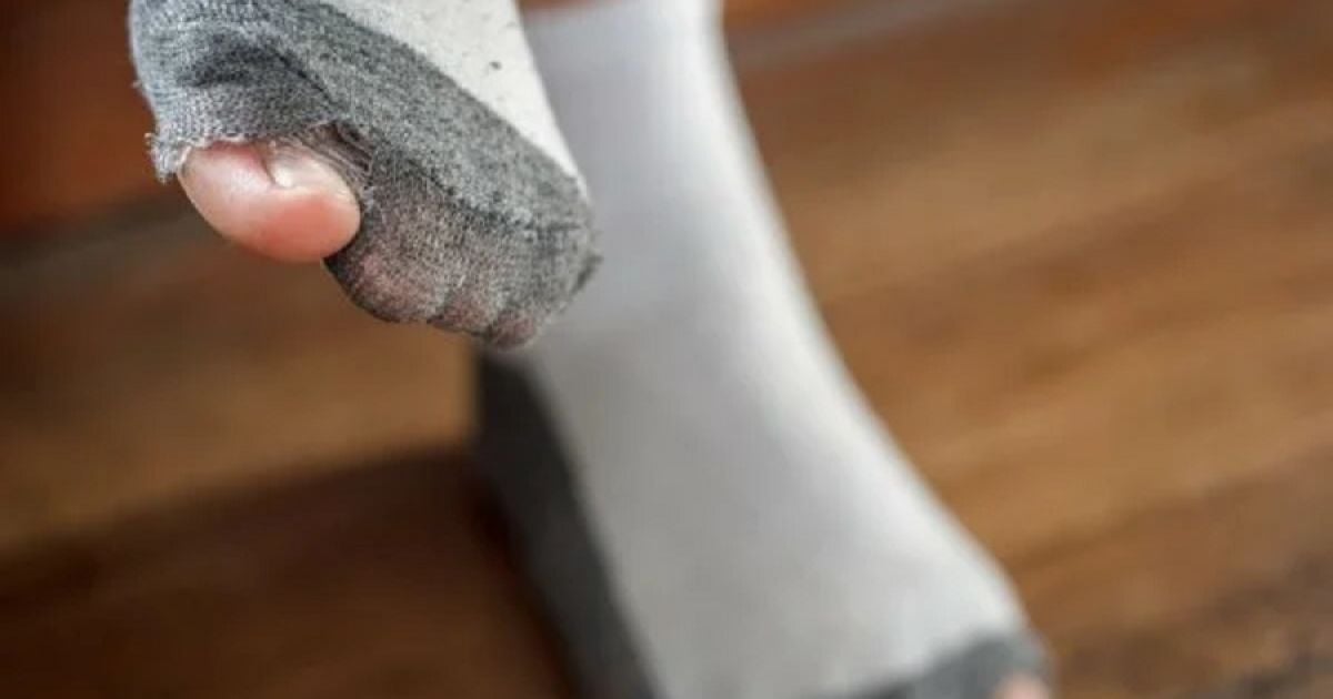 Не носи дырявые носки: почему это вредит кошельку и здоровью