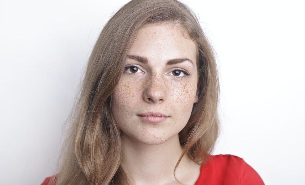 Пигментные пятна на лице: причины появления и эффективные методы удаления