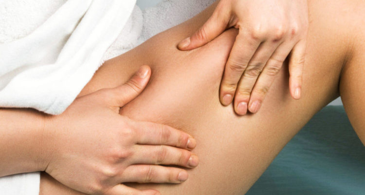 11 причин целлюлита: что говорят эксперты клиники Майо