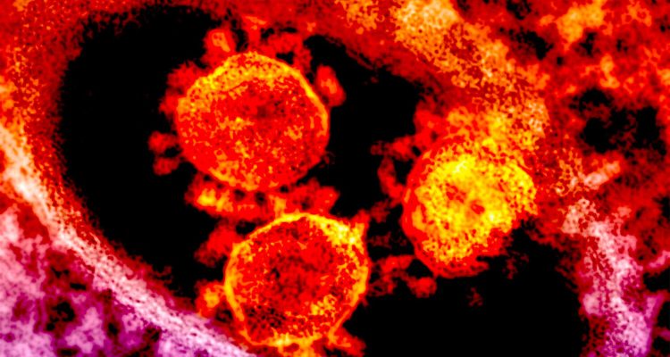 5 советов для женского здоровья: как защититься от вирусов и укрепить иммунитет