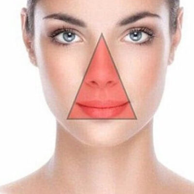 Кожа лица – зеркало здоровья: как определить болезни по высыпаниям и изменениям