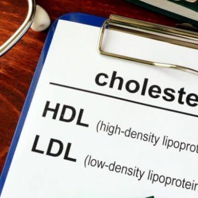 Как снизить холестерин: секреты женского здоровья и правильного питания