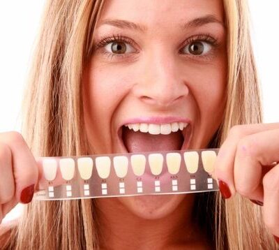 Продукты, окрашивающие эмаль: как сохранить белизну зубов