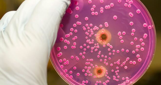 Молочница: причины, симптомы и эффективное лечение для женщин