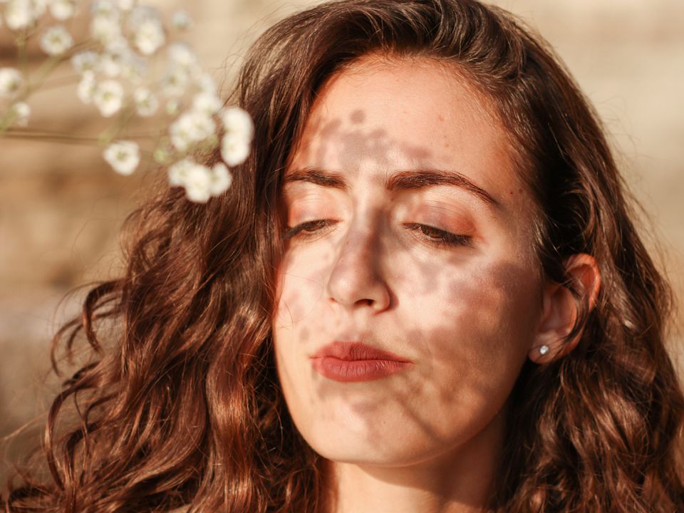 Как солнце влияет на кожу: почему появляются высыпания и как с ними бороться