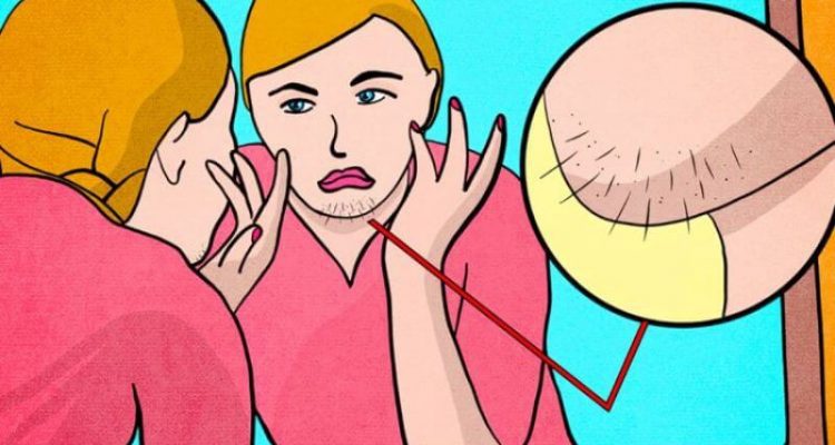 Признаки проблем с женским здоровьем: что может означать волосяной покров на лице