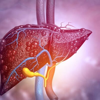 Признаки проблем с печенью у непьющих женщин