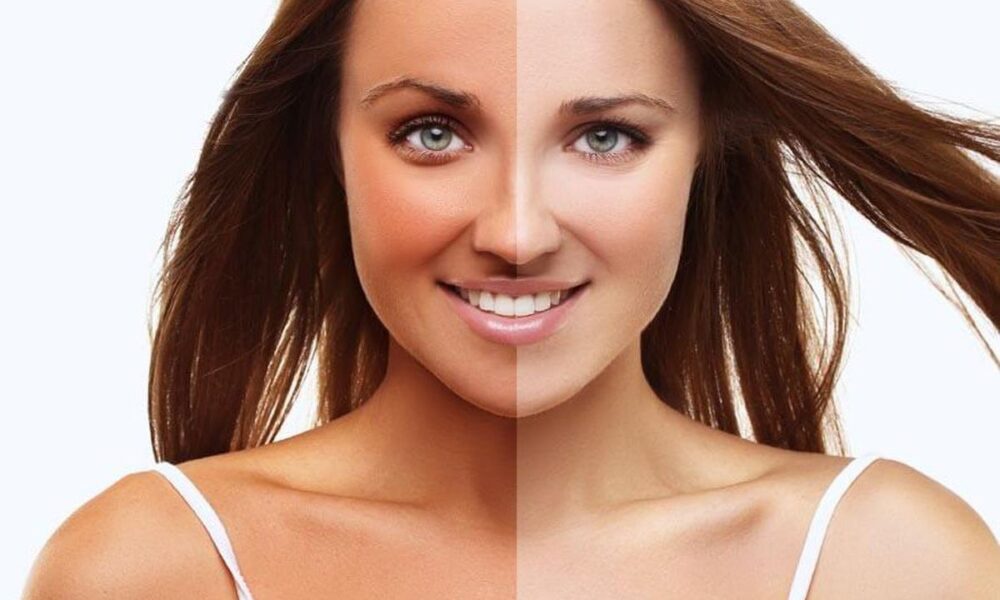 5 проверенных способов быстро избавиться от автозагара