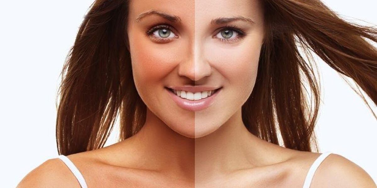 5 проверенных способов быстро избавиться от автозагара