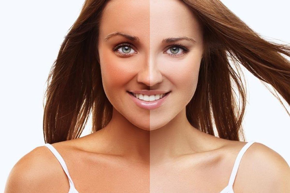 5 проверенных способов быстро избавиться от автозагара