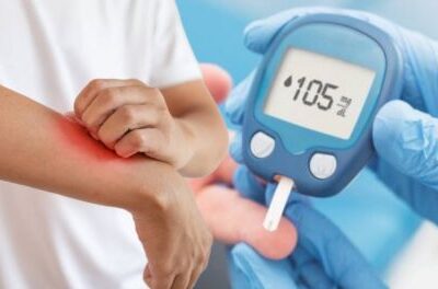 Признаки диабета 2 типа на коже: что нужно знать каждой женщине
