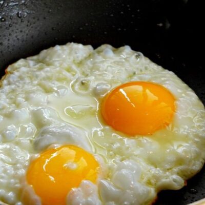 продукты, исключить из рациона, жирная кожа