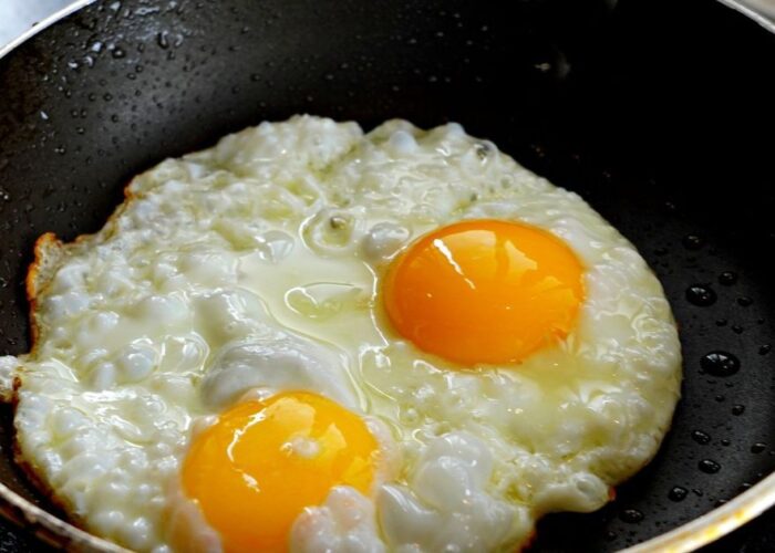 продукты, исключить из рациона, жирная кожа