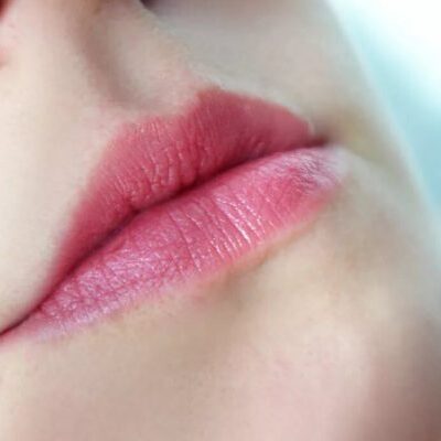 губы, трещины на губах, лечение трещин на губах